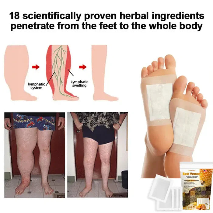 Bee Venom Lymphatic Detox & Slimming Foot Patches 🌿👣